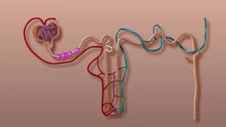Uso de glibenclamida en monitoreo de glucosa