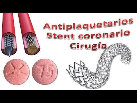 Efectividad del Clopidogrel en Angioplastia: Terapia Antiplaquetaria Optimizada