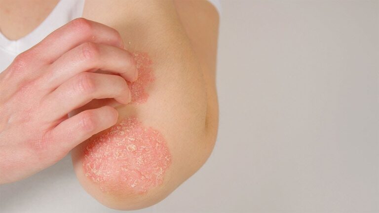 Farmacoterapia para enfermedades cut&aacute;neas