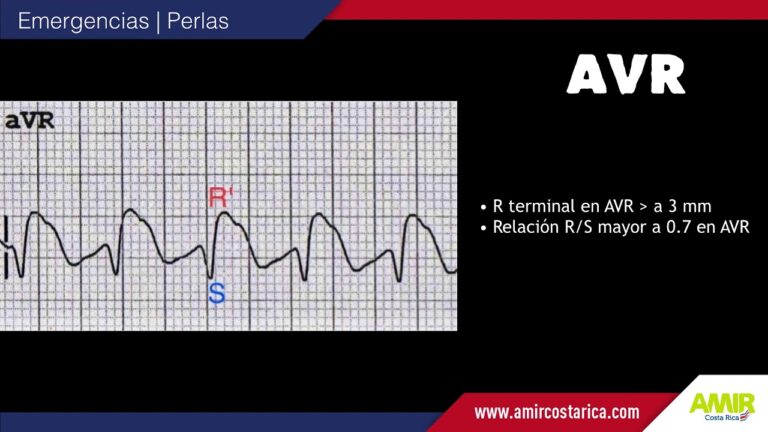 Indicaciones de la fluoxetina en pediatr&iacute;a: una revisi&oacute;n