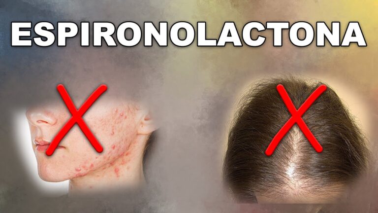 Espironolactona: Efectividad en el tratamiento del edema
