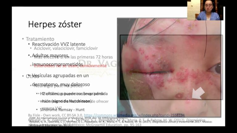 Famciclovir: Efectividad contra el virus del herpes