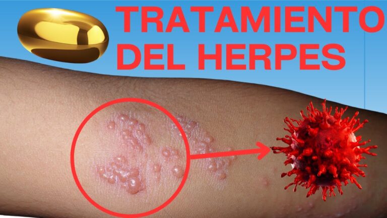 Famciclovir: tratamiento efectivo para el herpes z&oacute;ster