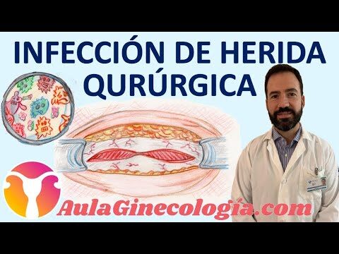 Clindamicina: Antibi&oacute;tico clave en profilaxis quir&uacute;rgica