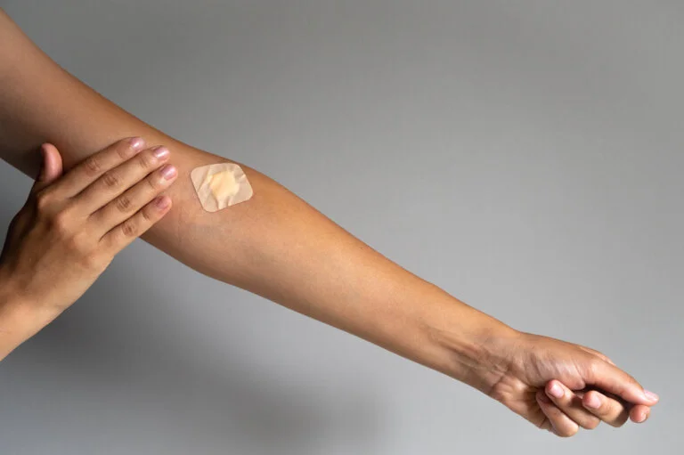 Parche Transd&eacute;rmico: Innovaci&oacute;n en Tratamientos Dermatol&oacute;gicos