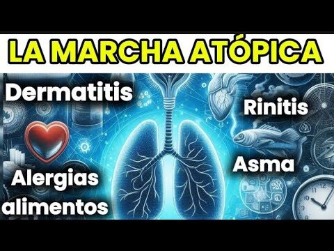 Prevenci&oacute;n de alergias nasales con budesonida