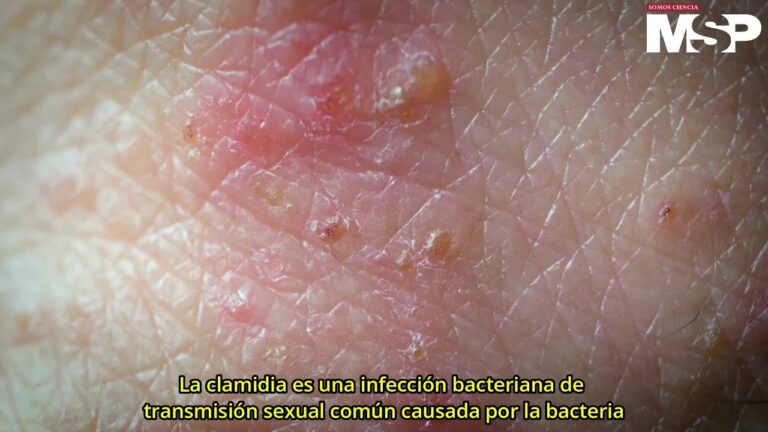 Receta de azitromicina para tratar la clamidia