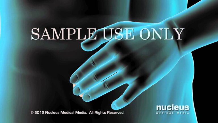 Pautas seguras para el uso de prednisona en terapia de mantenimiento