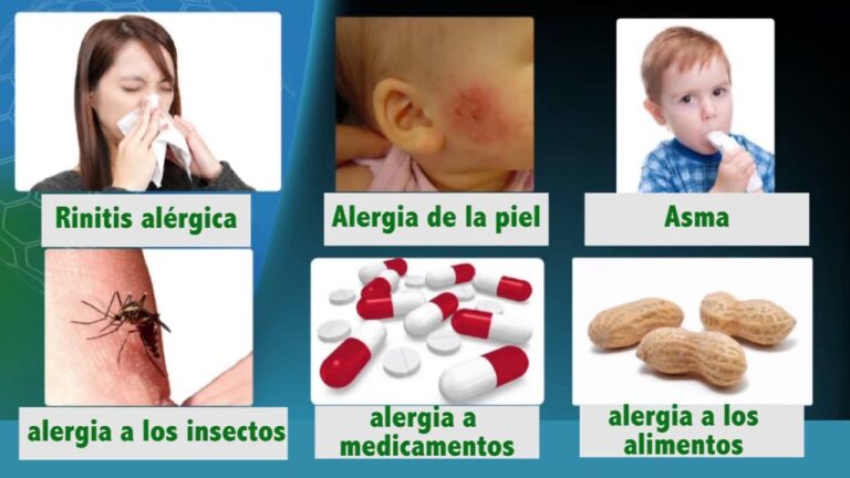 Soluciones para la alergia en la farmacia