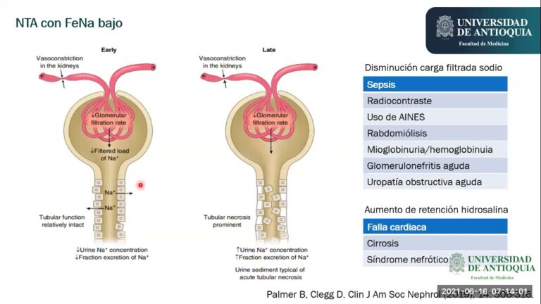 Espironolactona: clave en el tratamiento de la hiponatremia
