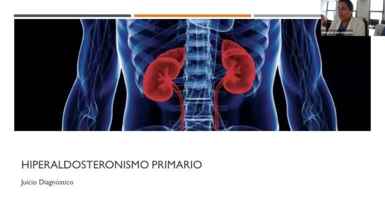 Espironolactona: tratamiento eficaz para la hipokalemia