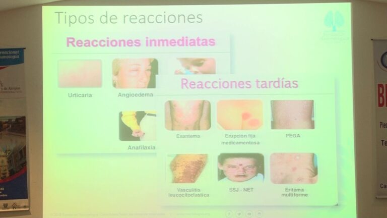 Alergia a penicilina: Informaci&oacute;n clave sobre la amoxicilina
