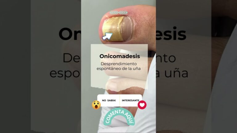 Secretos de belleza para uñas en la farmacia