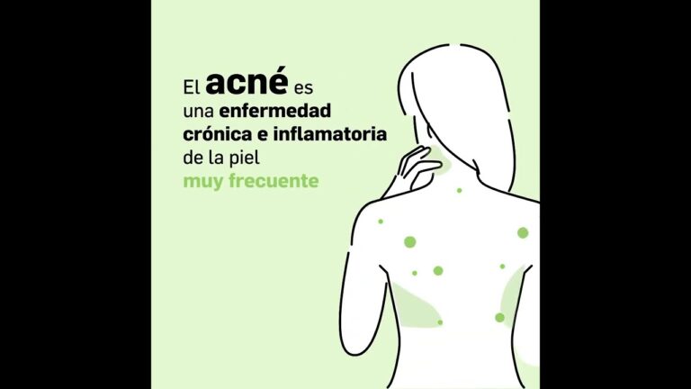 Gu&iacute;a de cuidado de la piel con productos farmac&eacute;uticos para el acn&eacute;