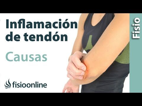 Uso de diclofenaco en el tratamiento de la tendinitis