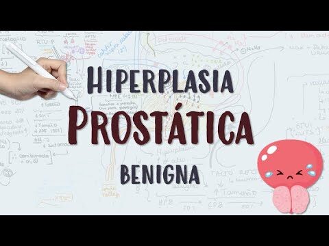 La eficacia de la tamsulosina para aumentar la micci&oacute;n