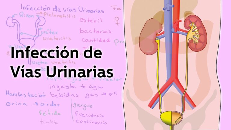 Ciprofloxacino: Prevención Efectiva de Enfermedades Infecciosas