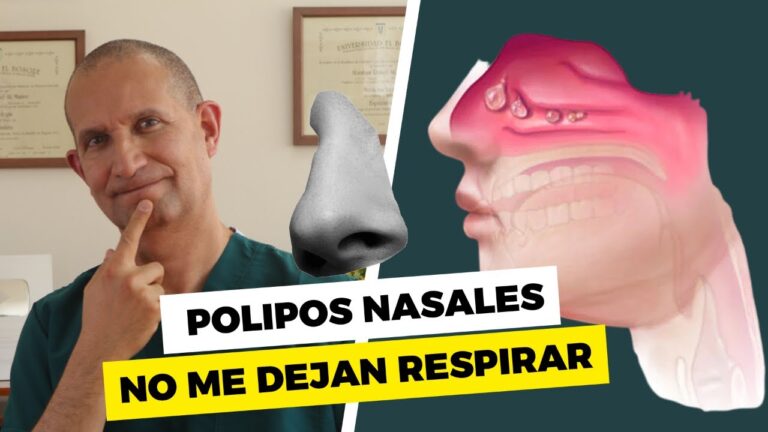 Budesonida: Efectividad en la Inflamaci&oacute;n Respiratoria