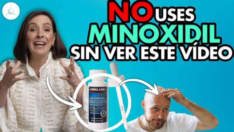 Riesgos de la Finasterida en Mujeres: Un An&aacute;lisis Cr&iacute;tico