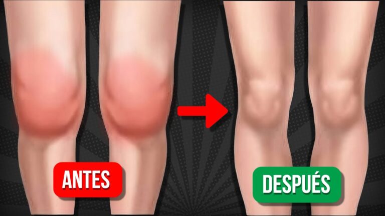 Enantyum: Soluci&oacute;n Efectiva para el Dolor Articular