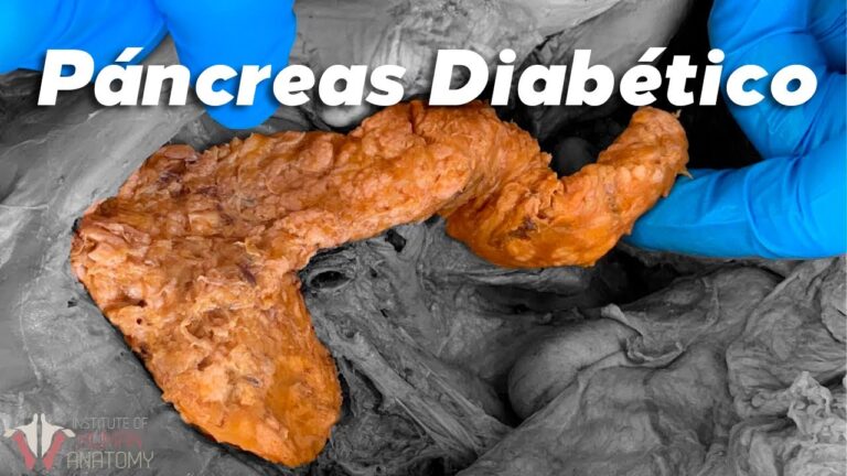 Impacto de la Glibenclamida en la Salud Cardíaca