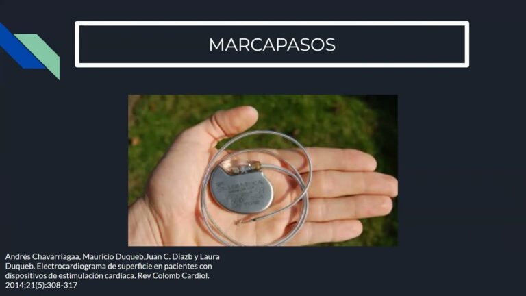 Clopidogrel como Tratamiento Adicional en Infarto de Miocardio