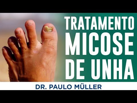 Alternativas Dermatol&oacute;gicas a la Finasterida para Problemas Capilares