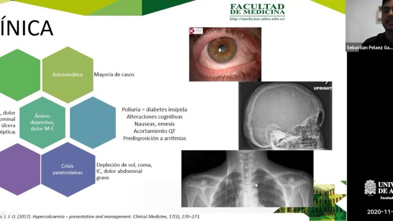 Hidroclorotiazida: Efectos en la Salud Renal