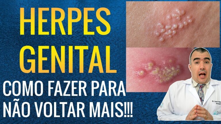 Efectividad del Famciclovir en el Tratamiento del Herpes Z&oacute;ster