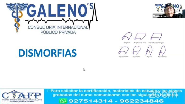 Ortopedia Funcional en Fisioterapia: Enfoques y Beneficios